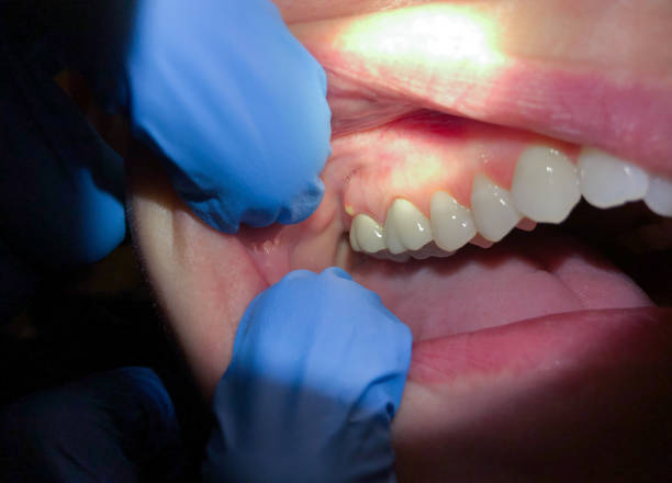 Best Emergency Treatment for Toothache in Leisuretowne, NJ