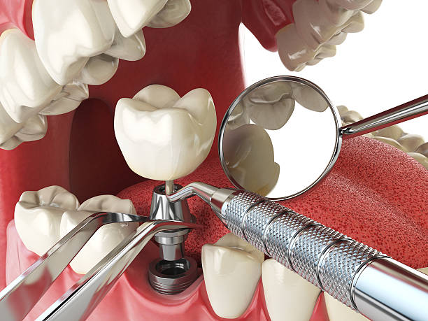 Best Emergency Tooth Extraction in Leisuretowne, NJ